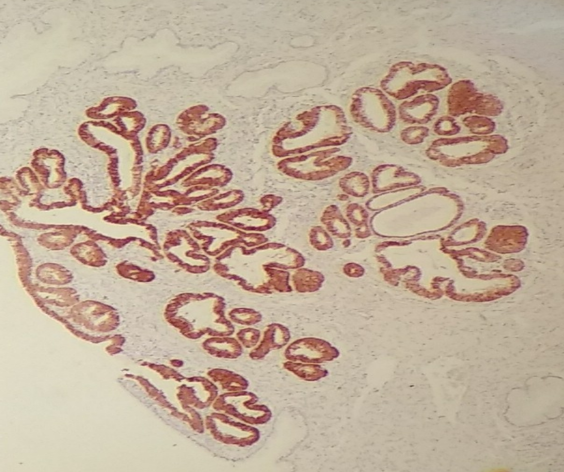 inmunohistoquimica hiq